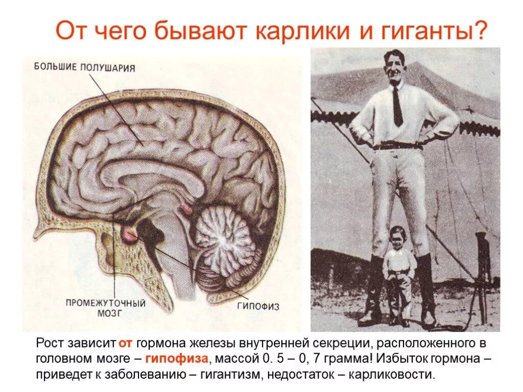 Гормон роста 8 класс. Гипофиз рост человека. Гипофиз карлики и гиганты. Гипофиз железа внутренней секреции. Гормон роста в мозгу.