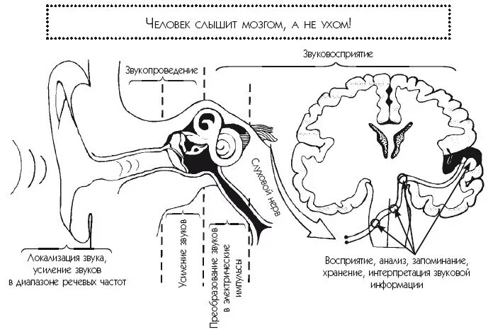 Слышу звуки которых нет. Причины центральных нарушений слуха. Как слышит ухо схема. Схема слухового анализатора. Нарушения слуха схема.