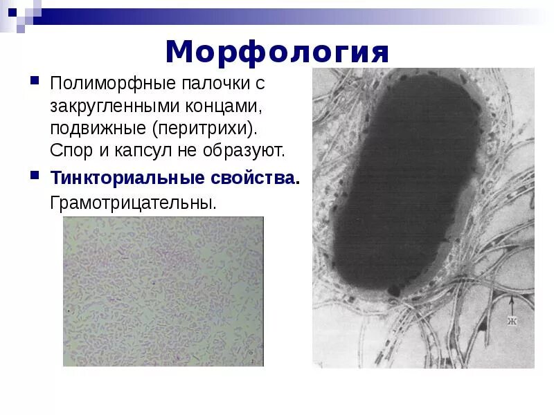 Полиморфная палочка. Превотеллы (род prevotella). Mycobacterium leprae морфология споры. Prevotella intermedia морфология. Стрептококк пневмония по граму мокроты.