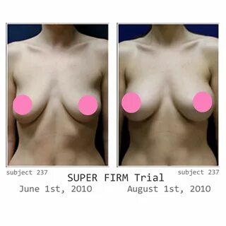 36d breasts