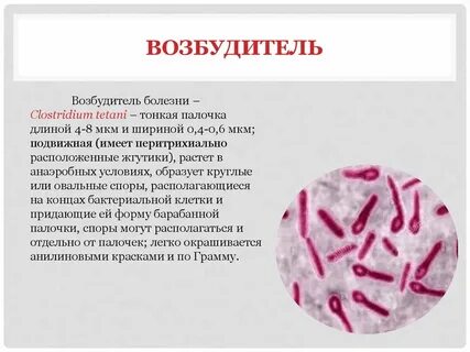 Столбняк возбудитель