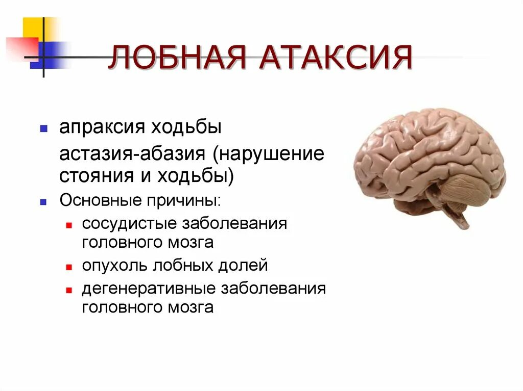 Корковая атаксия. Корковая атаксия. Мозжечковая атаксия нистагм. Симптомы атаксии. Лобная атаксия симптомы.