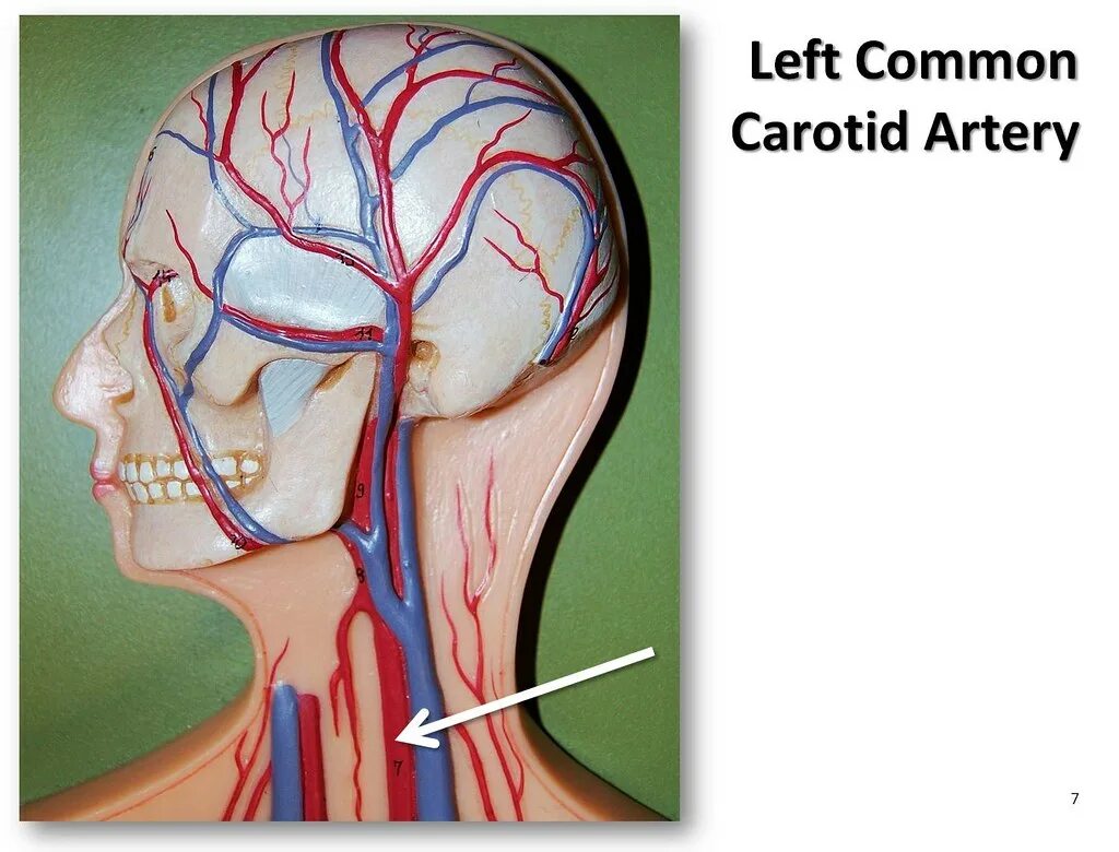 Где находится Сонная артерия у человека. Наружная Сонная артерия анатомия. Расположение сонной артерии на шее у человека. Левая Сонная артерия кровоснабжает. Где находится общая сонная артерия