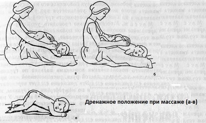 Постуральный массаж. Вибрационный массаж грудной клетки при бронхите у детей. Дренажный массаж ребенку для отхождения мокроты. Дренажный массаж грудничку для отхождения мокроты. Массаж для отхождения мокроты грудничку.
