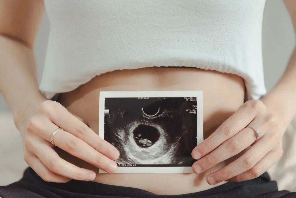 На каких сроках делается. УЗИ беременной. Первое УЗИ беременности. Скрининг беременных.
