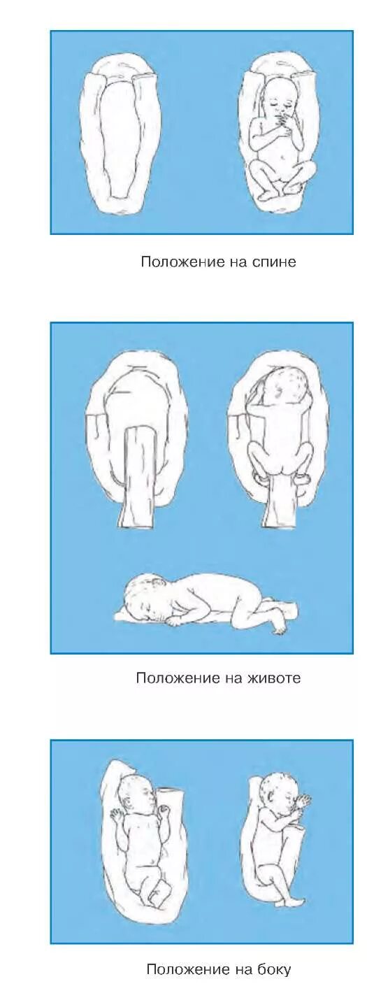 Положение плода в животе. Положение малыша в животе. Положение недоношенных детей. Варианты положения ребенка в животе. Правильное расположение ребенка в животе.