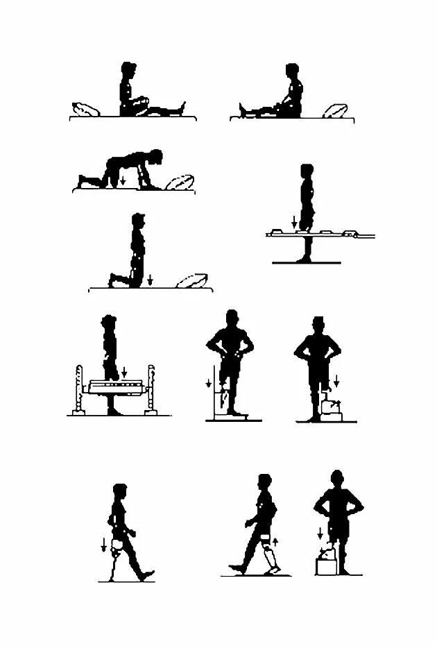 Комплекс упражнений ЛФК после ампутации конечности. ЛФК после ампутации нижней конечности. Упражнения при ампутации нижних конечностей. Комплекс ЛФК при ампутации нижних конечностей.