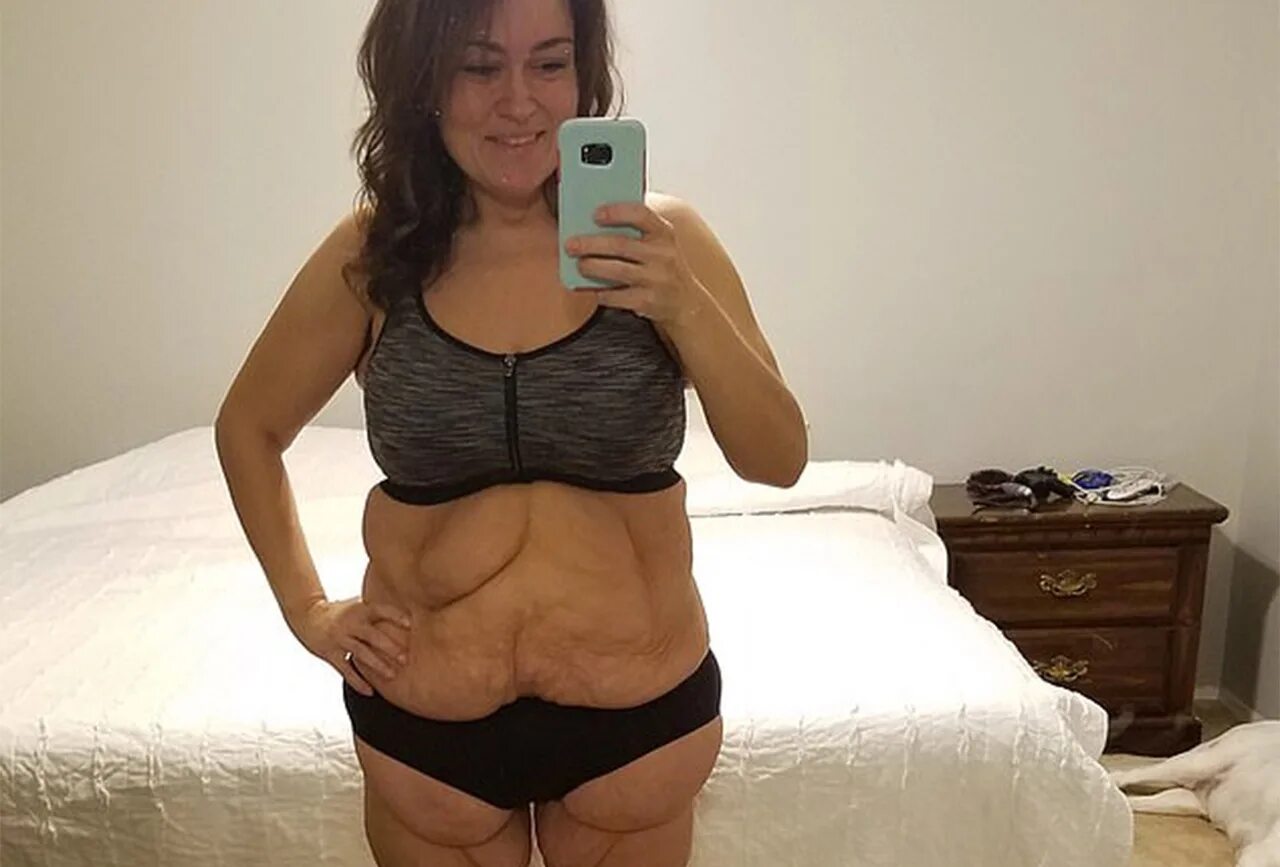 Похудение до и после. Женщина 35 кг. Стефани кинг растолстела$. Похудела на 80 кг. Фото похудевших.