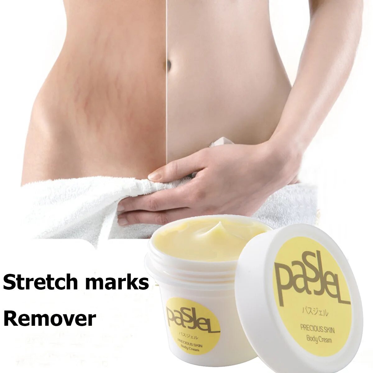 Stretch mark cream. Stretch Marks крем от растяжек. Стретч Маркс крем. Centella stretch Mark Repair Cream.