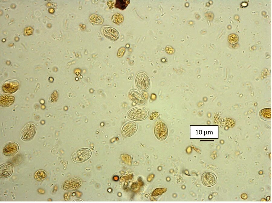 Цисты лямблии микроскопия. Ооцисты лямблий микроскопия. Цисты лямблий микроскопия. Цисты лямблий микроскопия кала. Споры в кале у взрослого