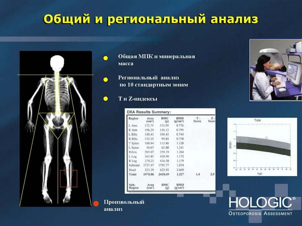Денситометрия костей в москве где. Денситометрия костей остеопороз. денситометрия презентация. что такое мпк в денситометрии. денситометрия зоны.
