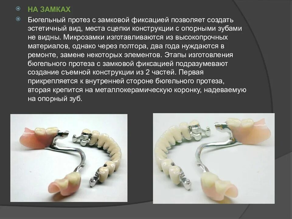 Фиксированная оплата труда условия применения. Модель системы управления запасами с фиксированным размером заказа. Фиксированная система. Фиксированная система. Система фиксированных валютных курсов.