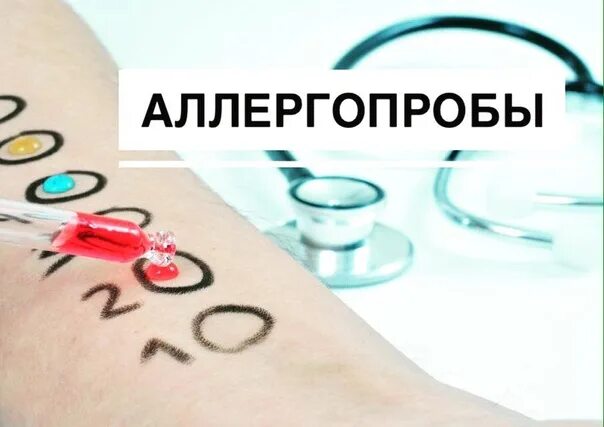 Какие аллергопробы делают. Аллергопробы на стоматологические материалы. кожное тестирование аллергопробы.