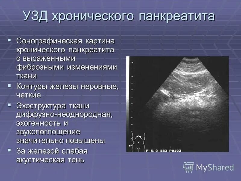 контуры железы неровные. контуры железы неровные. однородная структура узи. хронический неспецифический паренхиматозный сиалодохит. контуры железы неровные.