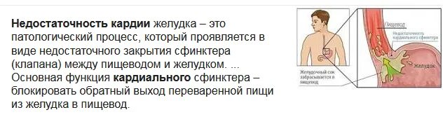 Кардия не смыкается что это значит. Недостаточность функции кардии. Недостаточность кардии симптомы. Кардия и привратник желудка. Недостаточность кардиального жома симптомы.