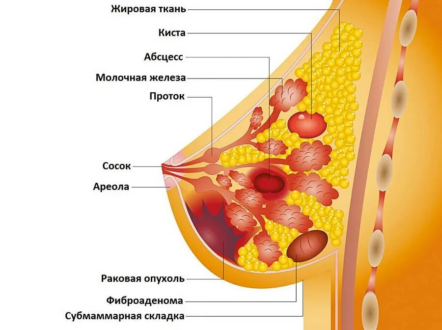 Уплотнение в молочной железе у женщин