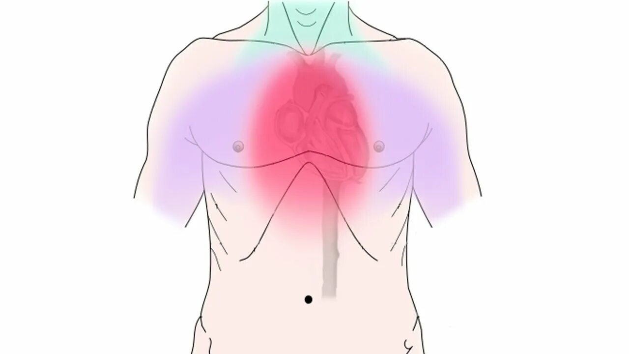 Неприятные ощущения за грудиной. Боли за грудиной рисунок.