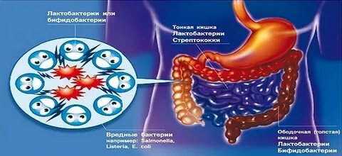 Дисбактериоз вызывает