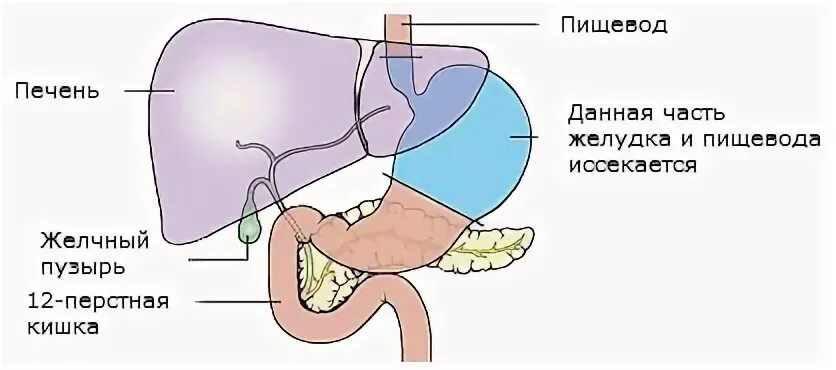 Выброс желчи во сне