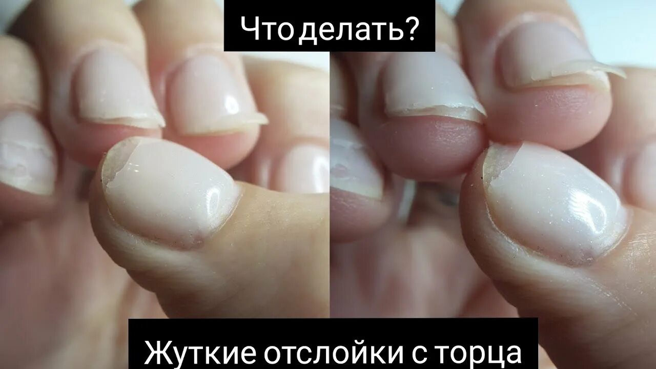 Отслойка ногтей под гель. Отслойки на ногтях гель лака.