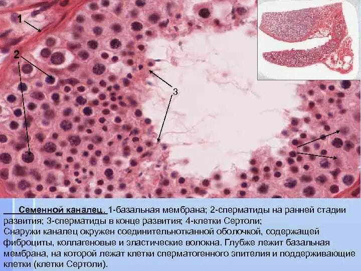 Базальная складчатость гистология. Схема ультрамикроскопического строения нефрона. Гемато текстикулярный барьер. Схема строения гематотестикулярного барьера. Источник развития клеток сертоли.