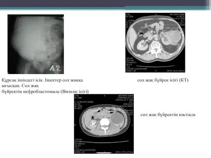 Жас порно видеомен секс
