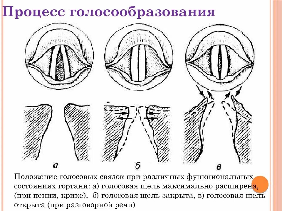 На рисунке изображены различные положения голосовых связок. Схема действия голосовых складок. Голосообразование фальцет. Голосовые связки при фонации. Механизм голосообразования схема.