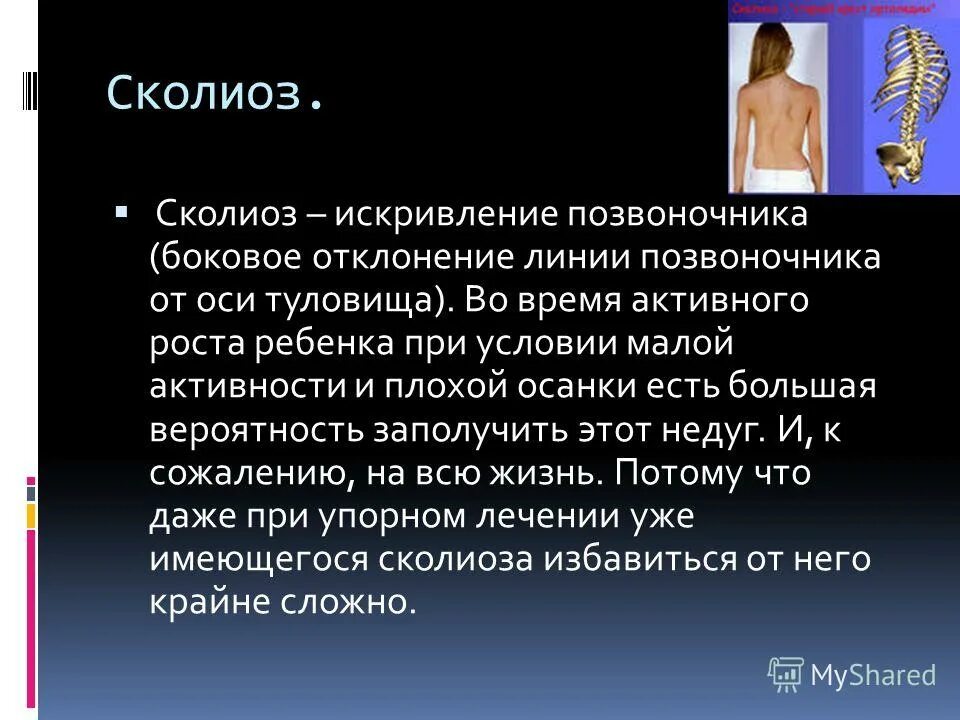 Сколиоз информация. Сколиоз информация