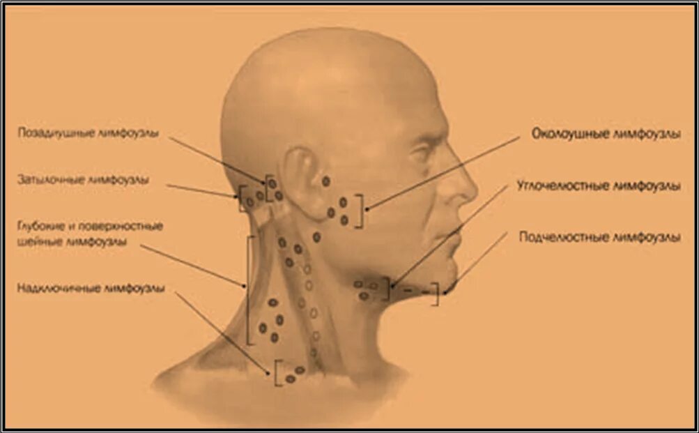 Лимфатический узел челюсть. Воспаленные околоушные лимфоузлы. Поднижнечелюстные лимфоузлы узлы. Подчелюстные и затылочные лимфоузлы.