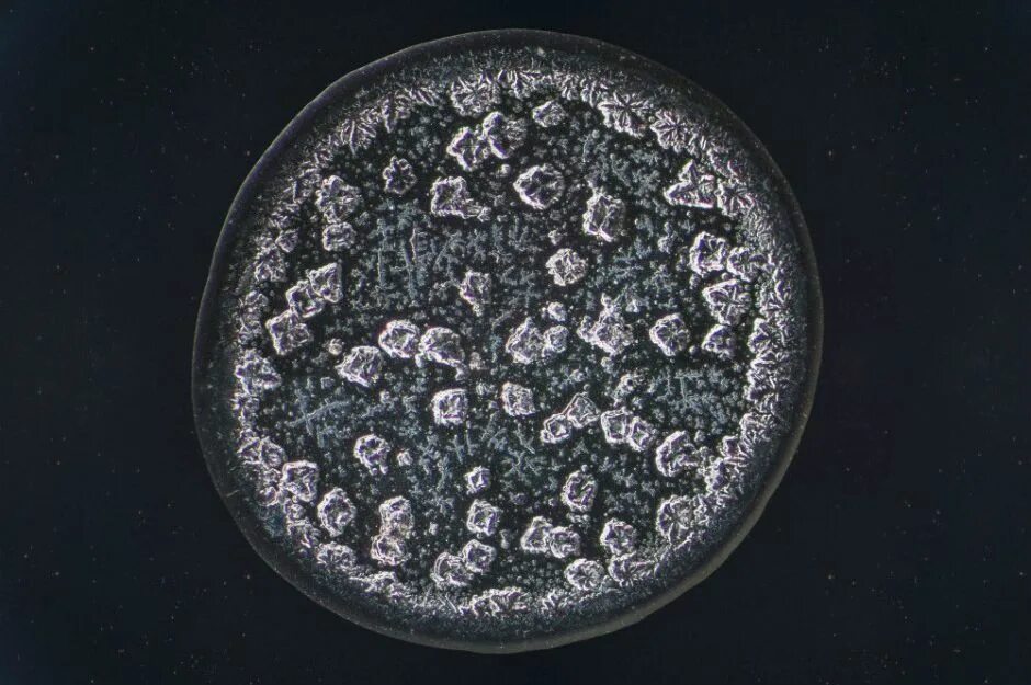 Как выглядит слеза под микроскопом 10 Amazing Photos Of The Human Body Under A Microscope Things under a microscope