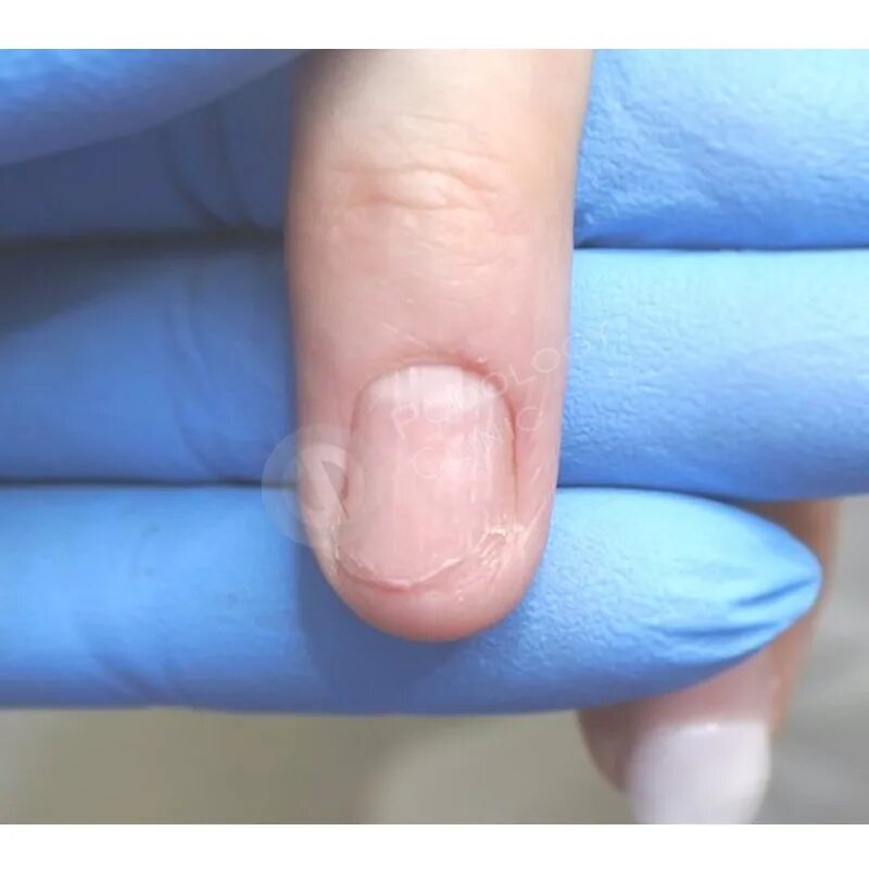 От чего синеют ногти