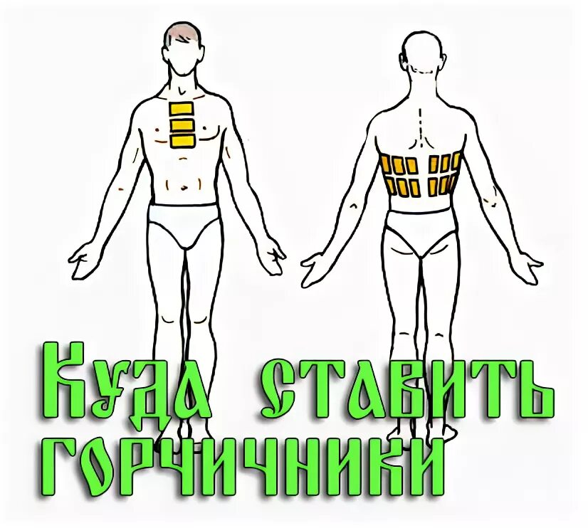 Можно ли ставить горчичники при кашле взрослому. Куда ставить горчичники. Горчичники на бронхи. Горчичники при кашле.