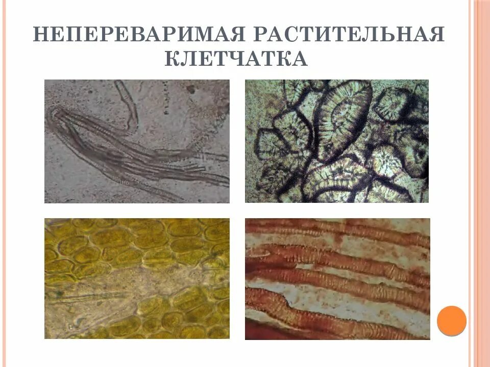 Перевариваемая растительная клетчатка в кале у ребенка. Микроскопия кал непереваримая клетчатка. Микроскопия кала растительная клетчатка переваримая. Непереваримая клетчатка в Кале. Микроскопия кала соединительная ткань.