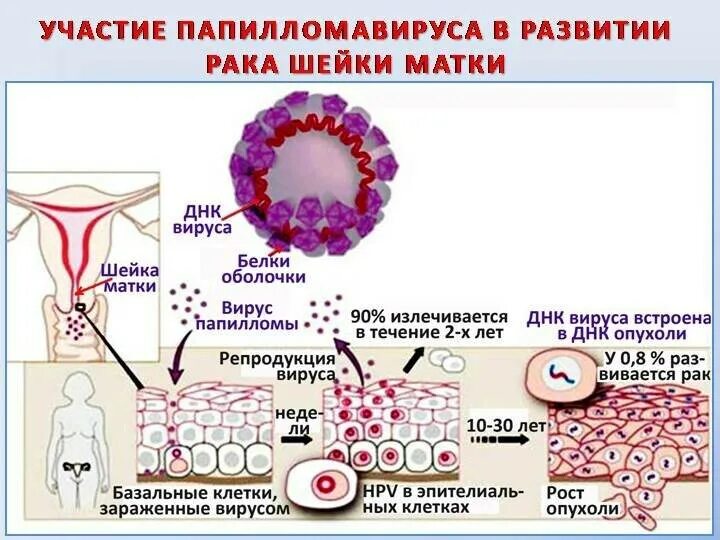 Изменение клеток матки. Патогенез папилломавирусной инфекции. ВИУС папиломы человека.