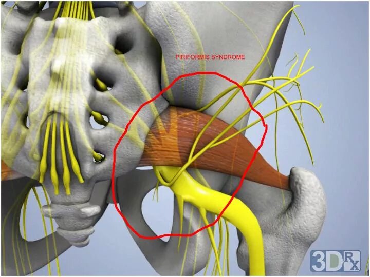 Мышца седалищного нерва. Грушевидная - Piriformis. Иннервация грушевидной мышцы. Седалищный нерв грушевидная анатомия. Грушевидная мышца и седалищный нерв.