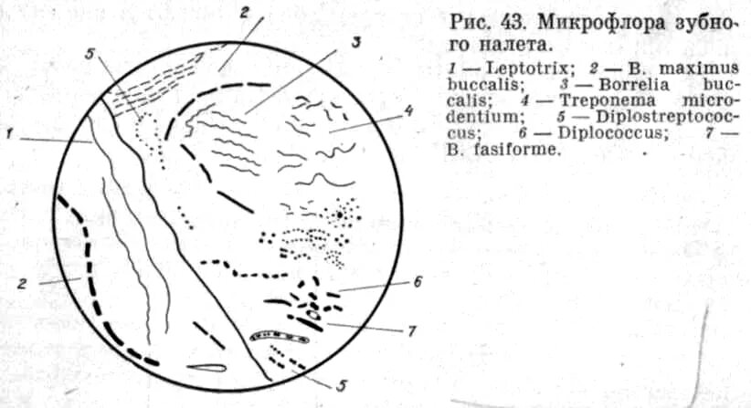 Микрофлора языка. Микроскопия зубного налета. Мазок зубного налета микробиология. Микроскопирование мазка из зубного налета. Приготовление мазка из зубного налета.