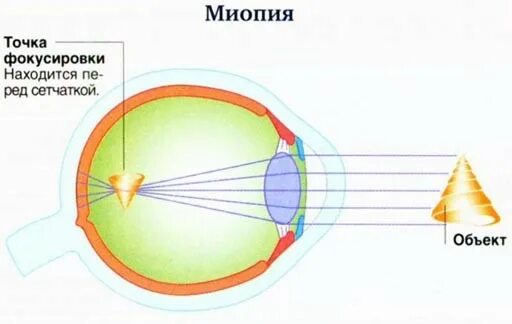 Регулирует поток света попадающего на сетчатку