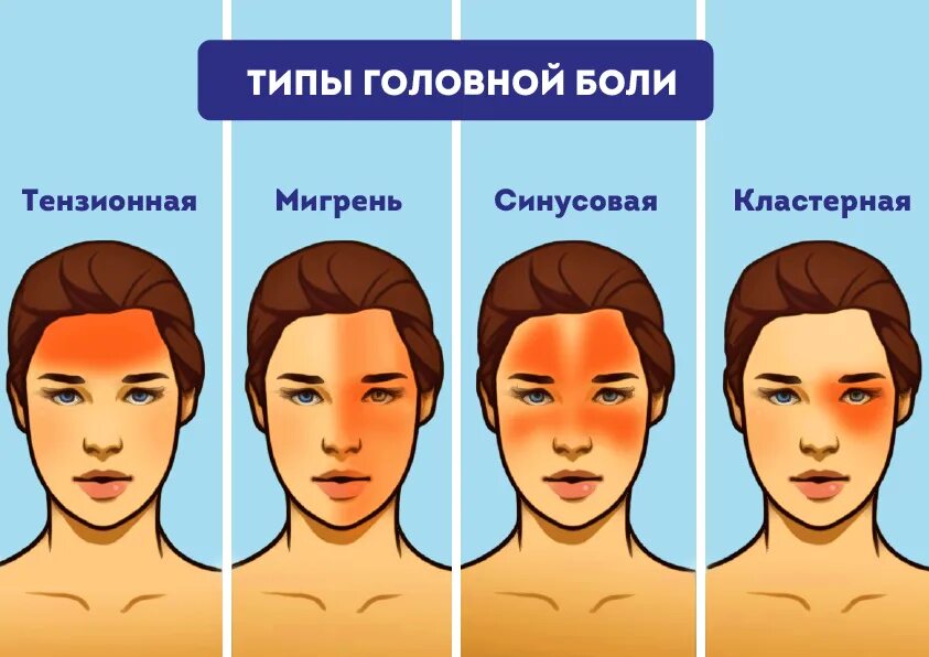 Причины головной боли. Зоны головных болей головы. Локализация головной боли и причины. Болит голова и левая сторона лица. Болит голова и левая сторона лица.
