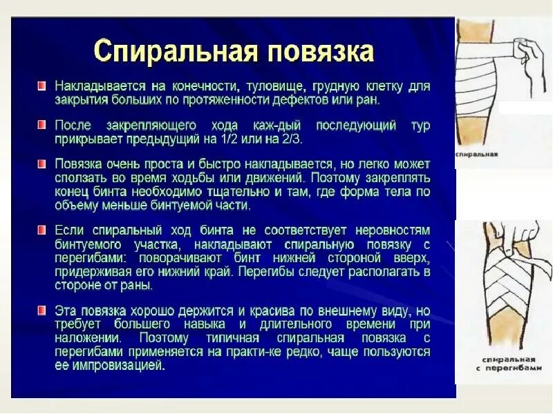 Способы и особенности фиксации конечностей. Наложение повязки на конечность. Порядок наложения повязки. Спиральная повязка на конечность. Правило наложение повязок.