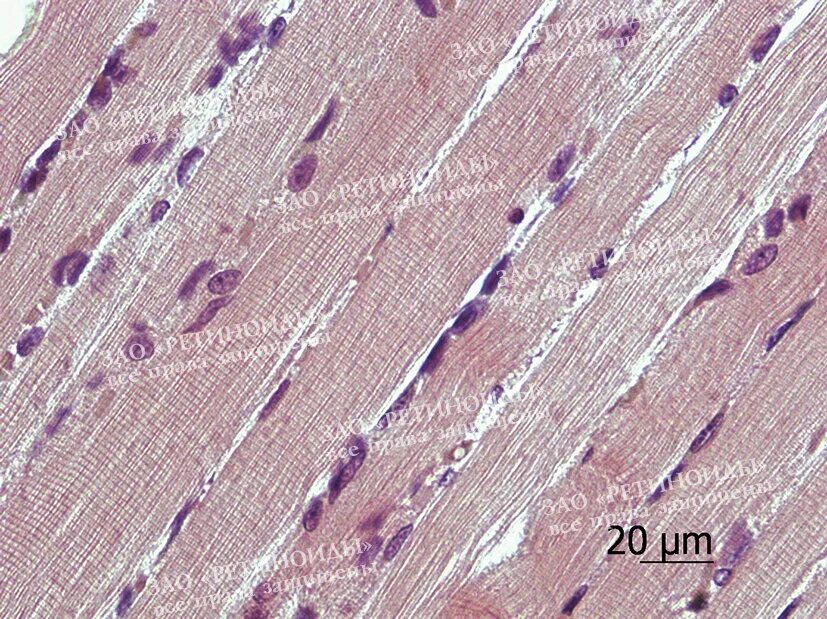 Иридоцилиарная меланома. Гистология кролика. Кокцидиоз печени кролика гистология. Однослойный призматический эпителий канальцев почки кролика. Листовиднвй сосочек язык гистология.