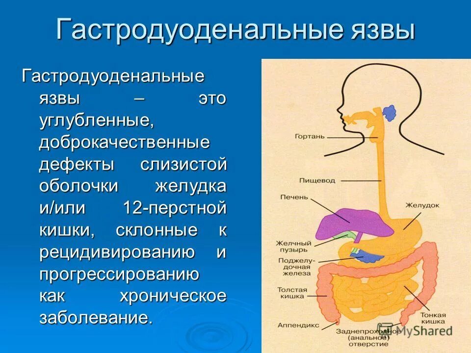 Осложнения желудка 12 перстной кишки