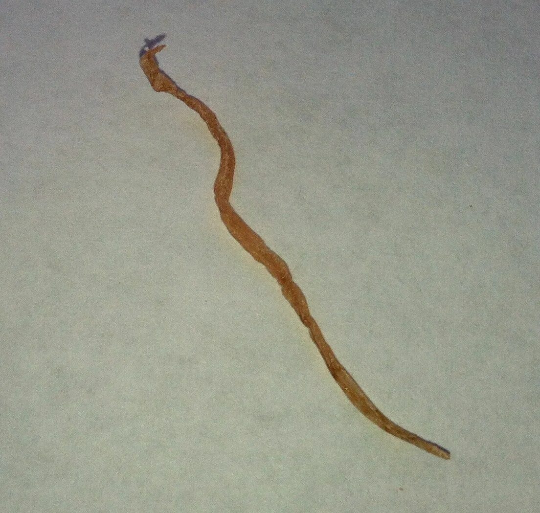 Белые червячки острицы. Кошачьи глисты анкилостома. Аскариды ленточные черви. Круглые гельминты,нематоды. Круглые паразитические черви черви.