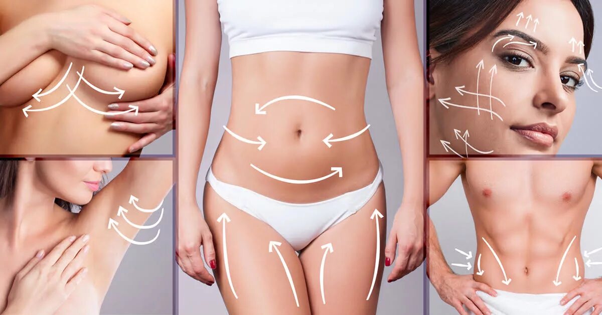 Body contour