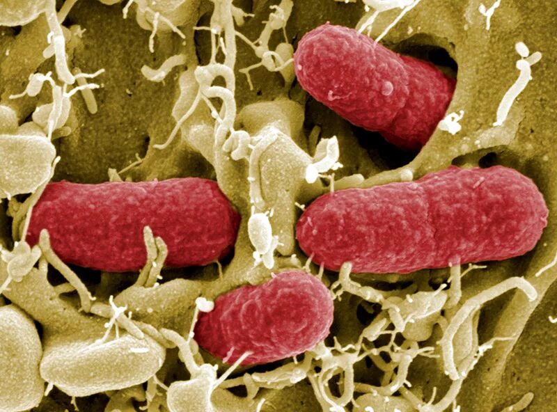 Coli sotwe. Бактерия Escherichia coli под микроскопом. Супербактерия кишечная палочка. Escherichia coli под микроскопом. Escherichia coli электронная микроскопия.