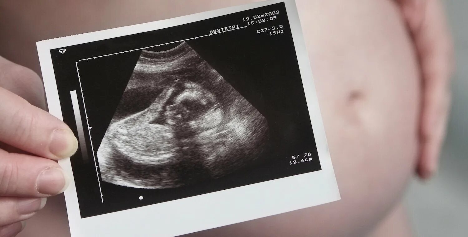 Беременность узи недели беременности видео. УЗИ 5 месяцев беременности. Снимок УЗИ 2 месяца беременности ребенка. УЗИ 3 месяца беременности. УЗИ 4 месяца беременности.