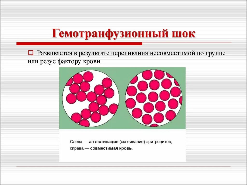 Гемотрансфузионный ШОК. Гемотрансфузионный ШОК при переливании крови. Гемотрансфузионный ШОК презентация. Гемотрансфузионный ШОК симптомы. Гемотрансфузия группа крови