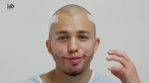 Откуда пересадка