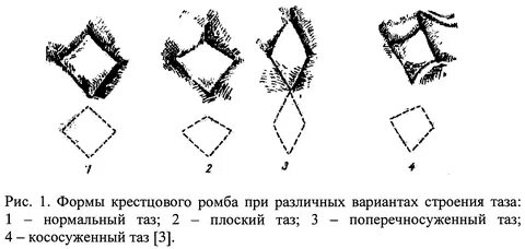 Их в различных формах и