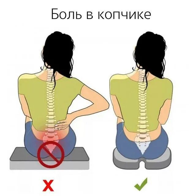 Боль в пояснице. Кресло для разгрузки позвоночника и спины. Копчик болит при сидении и вставании у женщин. Больно сидеть на твердом. Больно сидеть на твердом.