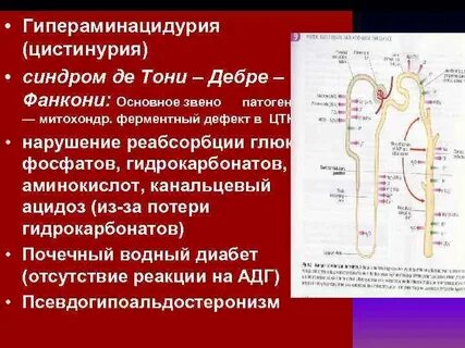 Синдром тони дебре фанкони